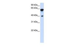 Anti-Dystrobrevin beta antibody, C-term used in Western Blot (WB). GTX46461