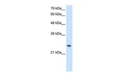 Anti-PPCDC antibody, N-term used in Western Blot (WB). GTX46462