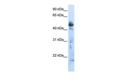 Anti-OXSM antibody, Internal used in Western Blot (WB). GTX46465