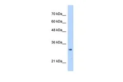 Anti-MRTO4 antibody, N-term used in Western Blot (WB). GTX46467