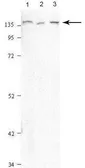 Anti-PFAS antibody, N-term used in Western Blot (WB). GTX46476
