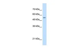 Anti-SHMT2 antibody, C-term used in Western Blot (WB). GTX46481