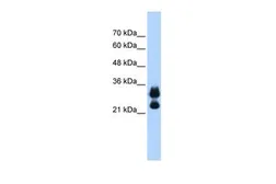 Anti-Histone H1.2 antibody, Internal used in Western Blot (WB). GTX46484