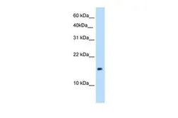 Anti-PAGE1 antibody, Internal used in Western Blot (WB). GTX46490
