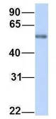 Anti-PPAT antibody, C-term used in Western Blot (WB). GTX46491