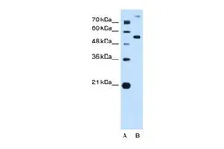 Anti-PPAT antibody, N-term used in Western Blot (WB). GTX46492