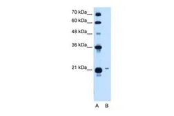 Anti-TCP10L antibody, Internal used in Western Blot (WB). GTX46509