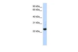 Anti-C21ORF56 antibody, N-term used in Western Blot (WB). GTX46512