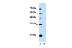 Anti-DONSON antibody, Internal used in Western Blot (WB). GTX46517
