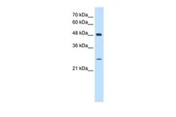 Anti-SH3BGR antibody, N-term used in Western Blot (WB). GTX46529