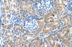 Anti-SGPP2 antibody, C-term used in IHC (Paraffin sections) (IHC-P). GTX46532