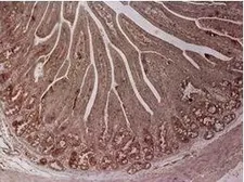 Anti-CPS1 antibody, Internal used in IHC (Paraffin sections) (IHC-P). GTX46535