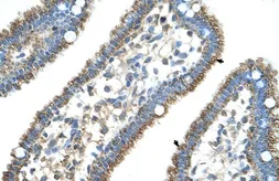 Anti-CPS1 antibody, N-term used in IHC (Paraffin sections) (IHC-P). GTX46536