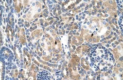 Anti-Mineralocorticoid Receptor antibody, Internal used in IHC (Paraffin sections) (IHC-P). GTX46537