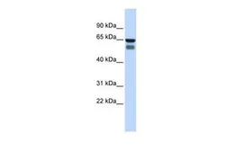 Anti-GALNT4 antibody, Internal used in Western Blot (WB). GTX46541