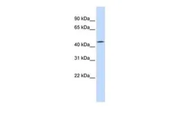 Anti-TMEFF1 antibody, Internal used in Western Blot (WB). GTX46543