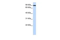 Anti-TFR2 antibody, N-term used in Western Blot (WB). GTX46553