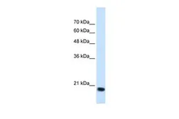 Anti-SSR2 antibody, N-term used in Western Blot (WB). GTX46554