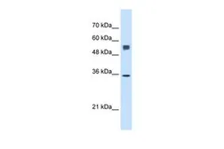 Anti-TRAP alpha antibody, N-term used in Western Blot (WB). GTX46556
