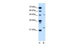 Anti-SMPD2 antibody, N-term used in Western Blot (WB). GTX46557