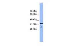 Anti-Fc epsilon R1 alpha antibody, N-term used in Western Blot (WB). GTX46570