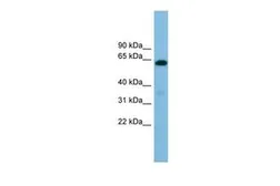Anti-B4GALNT1 antibody, Internal used in Western Blot (WB). GTX46573