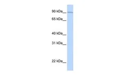 Anti-AOC2 antibody, Internal used in Western Blot (WB). GTX46578