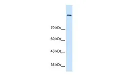 Anti-AOC2 antibody, Internal used in Western Blot (WB). GTX46579