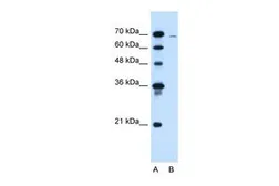 Anti-CLCC1 antibody, N-term used in Western Blot (WB). GTX46587