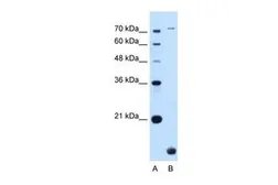 Anti-TMEM91 antibody, N-term used in Western Blot (WB). GTX46591