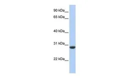 Anti-CLDND1 antibody, Internal used in Western Blot (WB). GTX46595