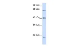 Anti-Nesprin 4 antibody, N-term used in Western Blot (WB). GTX46600