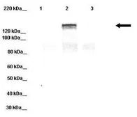 Anti-DPP6 antibody, Internal used in Western Blot (WB). GTX46611