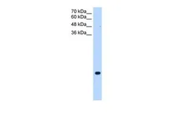 Anti-TMEM75 antibody, C-term used in Western Blot (WB). GTX46614
