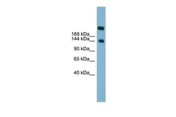 Anti-SI antibody, Internal used in Western Blot (WB). GTX46619