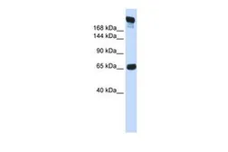 Anti-SI antibody, N-term used in Western Blot (WB). GTX46620