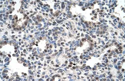 Anti-FAM134B antibody, Internal used in IHC (Paraffin sections) (IHC-P). GTX46621