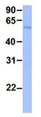 Anti-FAM134B antibody, Internal used in Western Blot (WB). GTX46622