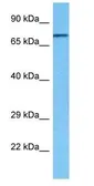 Anti-RHOT1 antibody, N-term used in Western Blot (WB). GTX46625