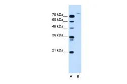 Anti-USP48 antibody, Internal used in Western Blot (WB). GTX46628