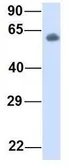 Anti-HAI-1 antibody, Internal used in Western Blot (WB). GTX46629