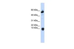 Anti-C1ORF151 antibody, Internal used in Western Blot (WB). GTX46630