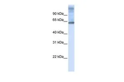 Anti-C3ORF17 antibody, Internal used in Western Blot (WB). GTX46638