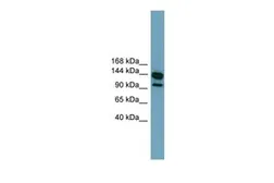 Anti-LRRC66 antibody, Internal used in Western Blot (WB). GTX46645