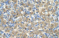 Anti-MARVELD3 antibody, Internal used in IHC (Paraffin sections) (IHC-P). GTX46649