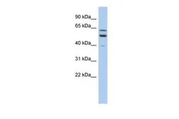 Anti-TMCC1 antibody, Internal used in Western Blot (WB). GTX46650
