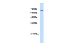 Anti-TM9SF1 antibody, N-term used in Western Blot (WB). GTX46659