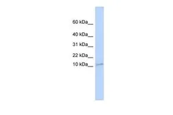 Anti-TMEM93 antibody, N-term used in Western Blot (WB). GTX46661