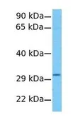 Anti-AGPAT2 antibody, C-term used in Western Blot (WB). GTX46672