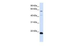 Anti-C14ORF180 antibody, N-term used in Western Blot (WB). GTX46689